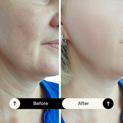 Skin Firming Cream