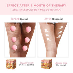 Facial Cupping Therapy Skin Care Set