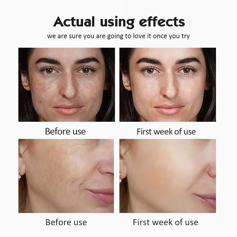 Vitamin C Brightening Skincare Serum
